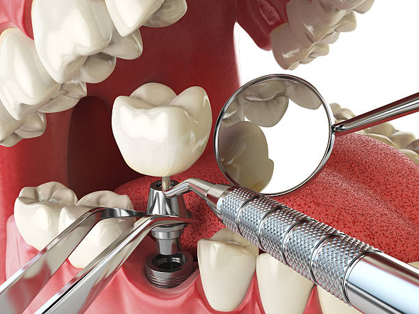 Best Weekend Emergency Dentist in Logansport, LA